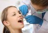 Обстоен преглед, план на лечение, почистване на зъбен камък, полиране с Air Flow и професионално избелване, от МР Дент - thumb 2