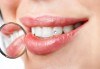 Поставяне на зъбно бижу в стоматологична клиника д-р Георгиев - thumb 1