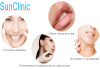 Уникална лифтинг процедура за зряла кожа! Мезоконци за изглаждане на контура на лицето и бръчките от SunClinic! - thumb 9