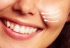 Уникална лифтинг процедура за зряла кожа! Мезоконци за изглаждане на контура на лицето и бръчките от SunClinic! - thumb 3