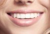 Обстоен дентален преглед, почистване на зъбен камък и зъбна плака с ултразвук и полиране с Air Flow в Deckoff Dental - thumb 1