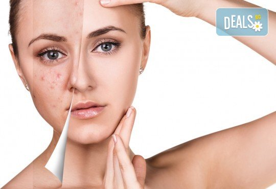 Дълбоко почистване на лице в 11 стъпки с нанасяне на седефен пилинг и матиращ флуид от Sunflower beauty studio - Снимка 1