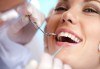 Професионално почистване на зъбен камък и полиране на всички повърхности с AirFlow, стоматологичен преглед и цялостен план за лечение в Dental Studio Perfect - thumb 2