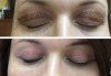 Незабавен резултат с видимо по-свеж поглед! Неоперативно повдигане на горен клепач и намаляване на торбичките под очите (блефароплсатика) от SunClinic! - thumb 4