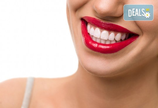 Холивудска усмивка! Професионално избелване на зъби със система и LED лампа от Sun-Dental - Снимка 2