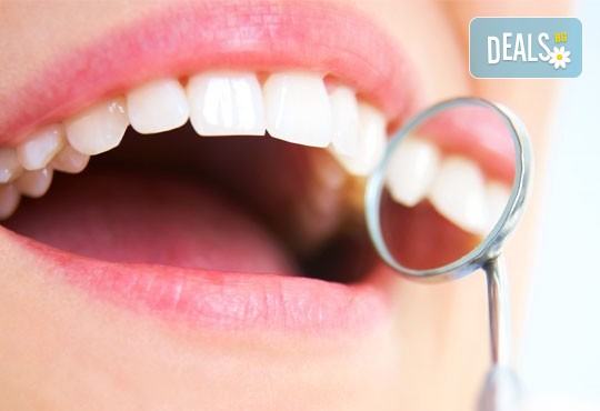 Поставяне на фотополимерна пломба или почистване на зъбен камък с ултразвук, полиране и обстоен преглед в дентална клиника Персенк - Снимка 1