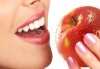 Красива усмивка с бондинг - поставяне на фотополимерна фаcета на един зъб в дентална клиника Персенк! - thumb 1
