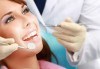 Лечебно-възстановителна процедура за укрепване на емайла на зъбите и лечение на кариеси - реминерализация в дентална клиника Персенк! - thumb 2