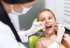 Поставяне на силант на постоянен детски зъб и бонус: 40 % отстъпка от всички процедури в дентален кабинет д-р Снежина Цекова! - thumb 2