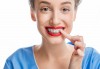 Усмихвайте се без притеснение! Поставяне на метални брекети за долна и горна челюст и 2 контролни прегледа в DentaLux! - thumb 1