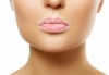 Уголемяване на устни със 100% хиалуронова киселина и ултразвук - 1 или 4 процедури, в салон за красота Теди! - thumb 3