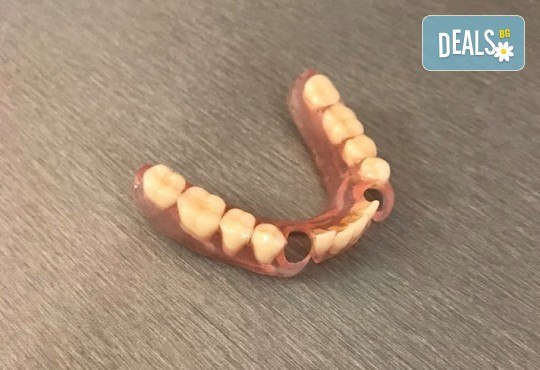 Изработване и поставяне на последно поколение меки силиконови протези VertexThermoSens от Дентална клиника Персенк! - Снимка 4