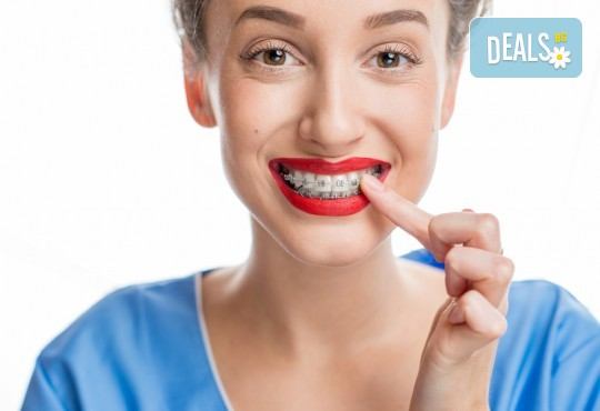 Консултация с ортодонт и 15% намаление от релната цена на лечението с брекети в DentaLux! - Снимка 3