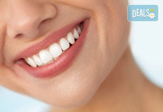 За красива и здрава усмивка! Почистване на зъбен камък с ултразвук, полиране и профилактичен преглед в Sofia Dental! - Снимка 1