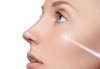 Красива и чиста кожа с почистваща и подмладяваща терапия за лице с лазер от Д-р Вълчев - сертифициран лекар дерматолог! - thumb 3
