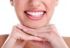Здрави зъби! Обстоен профилактичен преглед и лечение на пулпит на еднокоренов зъб в DentaLux! - thumb 2