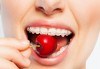 Здрави и красиви зъби! Консултация с ортодонт и 15 % отстъпка от цената на лечението с брекети в DentaLux! - thumb 1