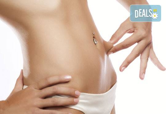 Изваяна фигура! Кавитация + RF на зона по избор - 1 или 8 процедури, в Anima Beauty&Relax! - Снимка 2