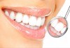 Комбинация от професионално избелване на зъби с LED лампа, профилактичен преглед, ултразвуково почистване на плака и зъбен камък, полиране на зъбите с Аir Flow и професионално домашно избелване на зъби с индивидуални шини! - thumb 2