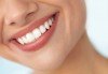 Комбинация от професионално избелване на зъби с LED лампа, профилактичен преглед, ултразвуково почистване на плака и зъбен камък, полиране на зъбите с Аir Flow и професионално домашно избелване на зъби с индивидуални шини! - thumb 3