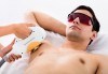 IPL фотоепилация на зона по избор за мъже в салон Орхидея в Центъра - thumb1 2