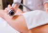 Идеално тяло! 5 или 7 антицелулитни процедури: кавитация, терапия с глина, сауна одеало, целутрон, пресотерапия, вибро колан и crazy fit в Senses Massage & Recreation! - thumb 3