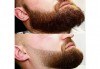 Мъжко подстригване и оформяне на брада и мустаци от професионален Barber в салон за красота Киприте! - thumb 5