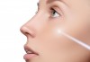 Терапия за лице и тяло! Комбиниран метод с лазер, микродермабразио и натурален Collagen на Laboratorios Tegor, от Центрове Енигма! - thumb 4