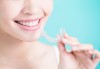 Домашно избелване на зъби с индивидуални шини, преглед и ултразвуково почистване на плака и зъбен камък в Дентален кабинет д-р Снежина Цекова - thumb 2